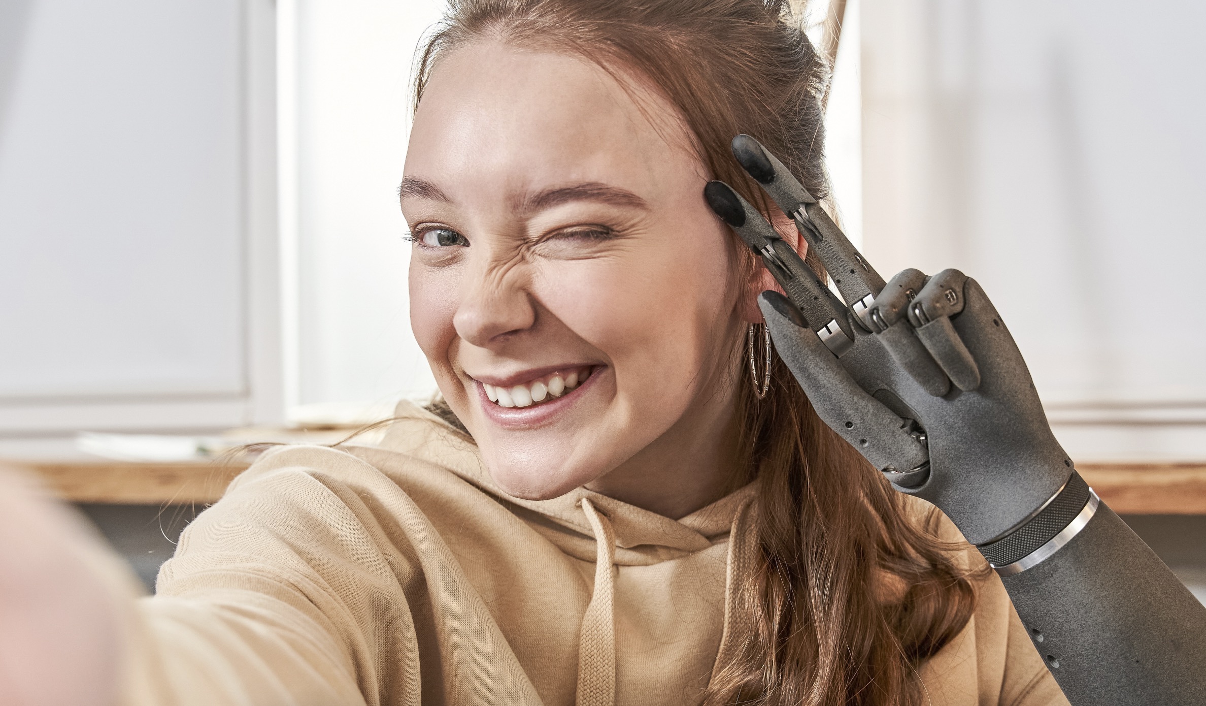 Український виробник біонічних протезів Esper Bionics залучив $5 млн для глобальної експансії