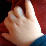 В Індії народилася дитина з 4 руками, 4 ногами та 2 обличчями. Чи вижило немовля?