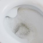 Що означає, якщо ваш кал білого кольору?