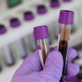 Як самостійно розшифрувати аналіз крові: покроковий посібник для пацієнтів