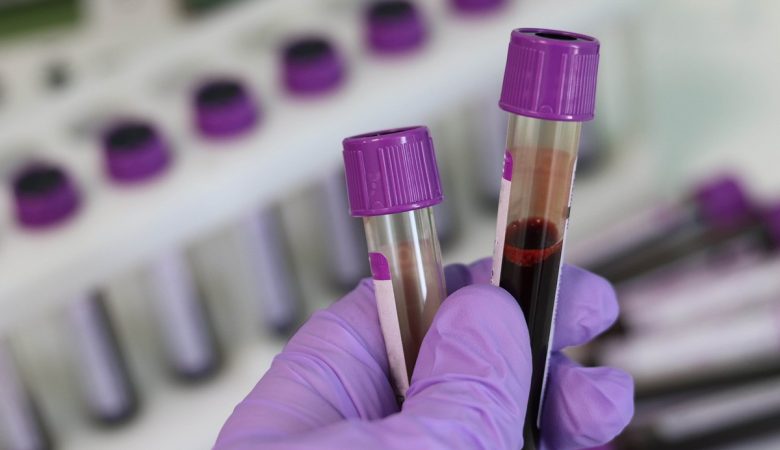 Як самостійно розшифрувати аналіз крові: покроковий посібник для пацієнтів