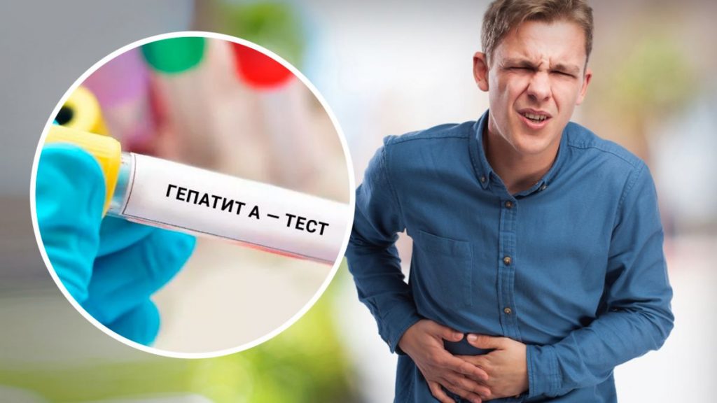 У Києві зафіксували спалах гепатиту А: як передається вірус і як себе захистити