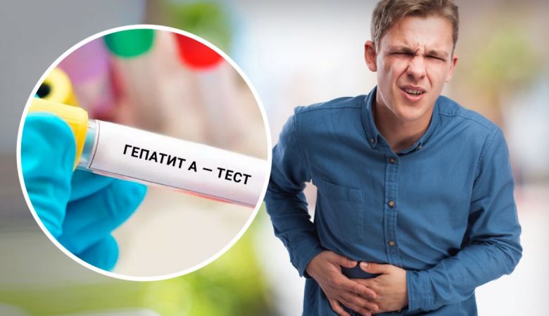 У Києві зафіксували спалах гепатиту А: як передається вірус і як себе захистити