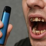 Чому вейпи можуть призвести до втрати зубів і захворювань ясен: небезпеки, які ховаються за модною звичкою