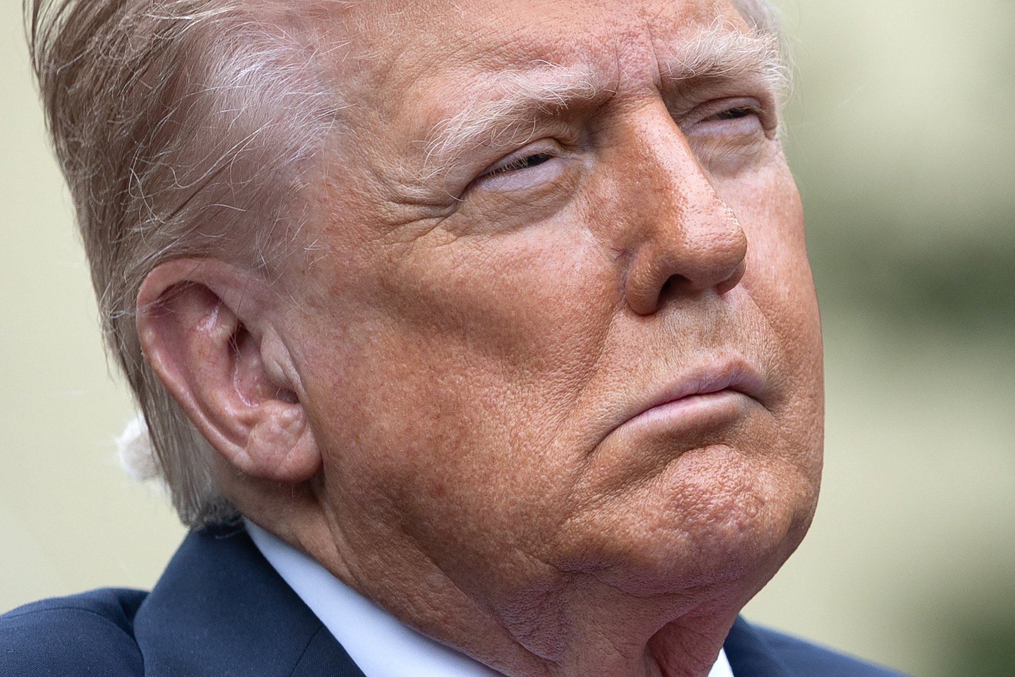 Що сталося з Трампом 11 вересня та чому ЗМІ заговорили про інсульт