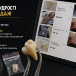 Як українці заробляють на видалених зубах мудрості у 2026 році