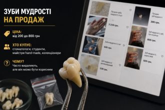Як українці заробляють на видалених зубах мудрості у 2026 році