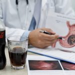 Що таке фітобезоар і як Coca-Cola Zero допомогла жінці уникнути операції
