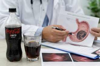 Що таке фітобезоар і як Coca-Cola Zero допомогла жінці уникнути операції