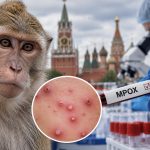 Мавпяча віспа в Росії: скільки людей потрапили до лікарень, як передається інфекція та чи загрожує вона Україні