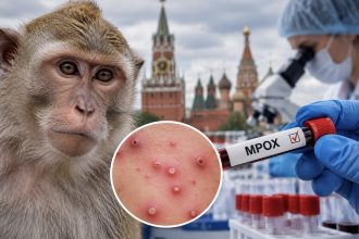 Мавпяча віспа в Росії: скільки людей потрапили до лікарень, як передається інфекція та чи загрожує вона Україні